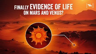 Watch Life Found on Mars & Venus? New Evidence Shocks Scientists!