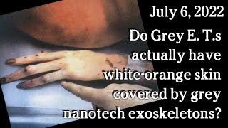 Watch July 6, 2022 - Do Grey E. T.s actually have white-orange skin covered by grey nanotech exoskeletons?