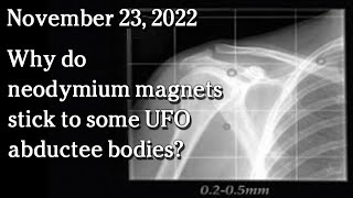 Watch Nov 23 - Why do neodymium magnets stick to some UFO abductee bodies?