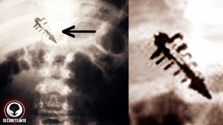 Watch IF YOU FIND THIS STRANGE MARK ON YOUR SKIN... RUN.